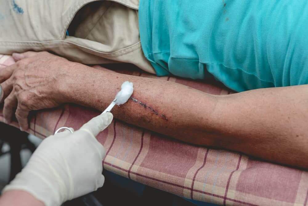 The Steps to Take after a Dog Bite in New Jersey