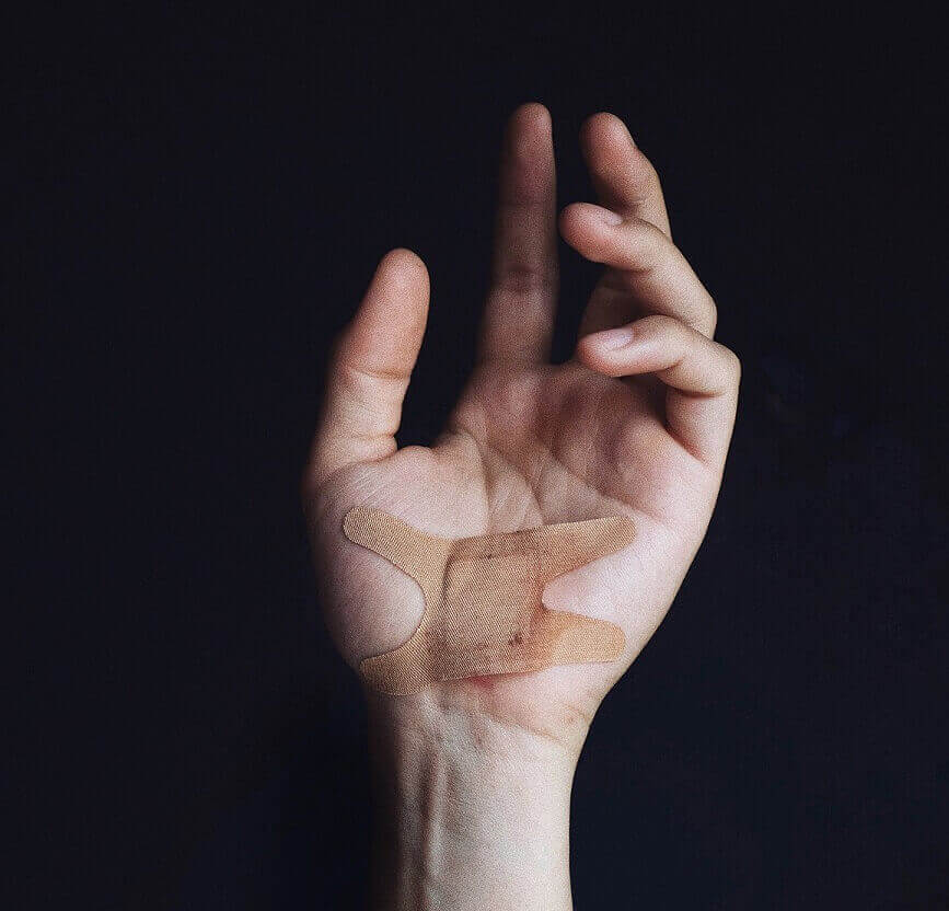 Minor wound from dog bite on hand
