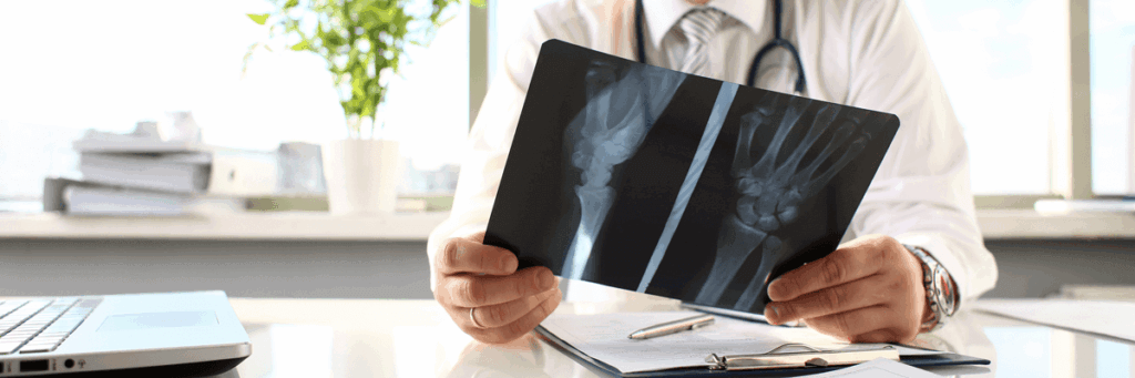 broken-bone-1