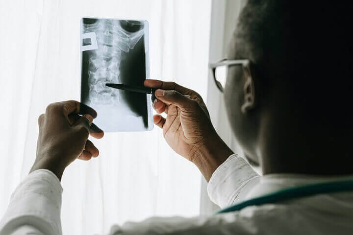 Doctor looking at xray of spine to assess nerve damage